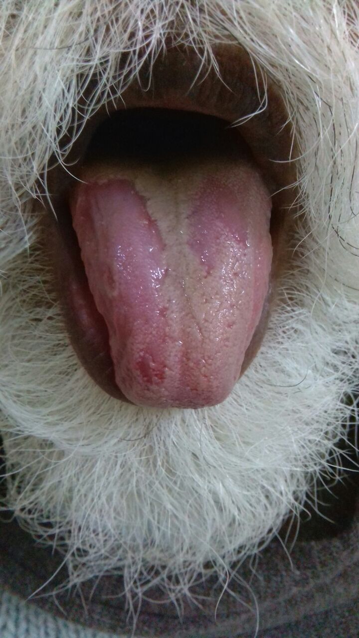 Identify This Tongue Condition
